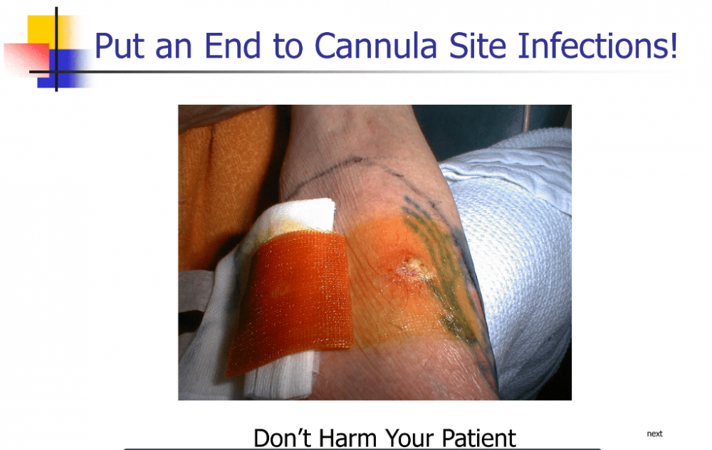 Put an end to cannula site infections! Other hospitalbased clinical