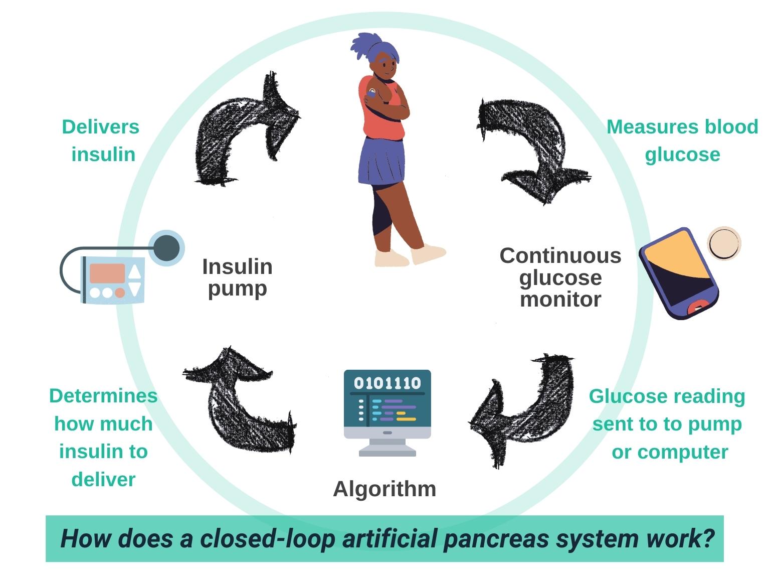 How safe are closed loop artificial pancreas systems? Diabetes
