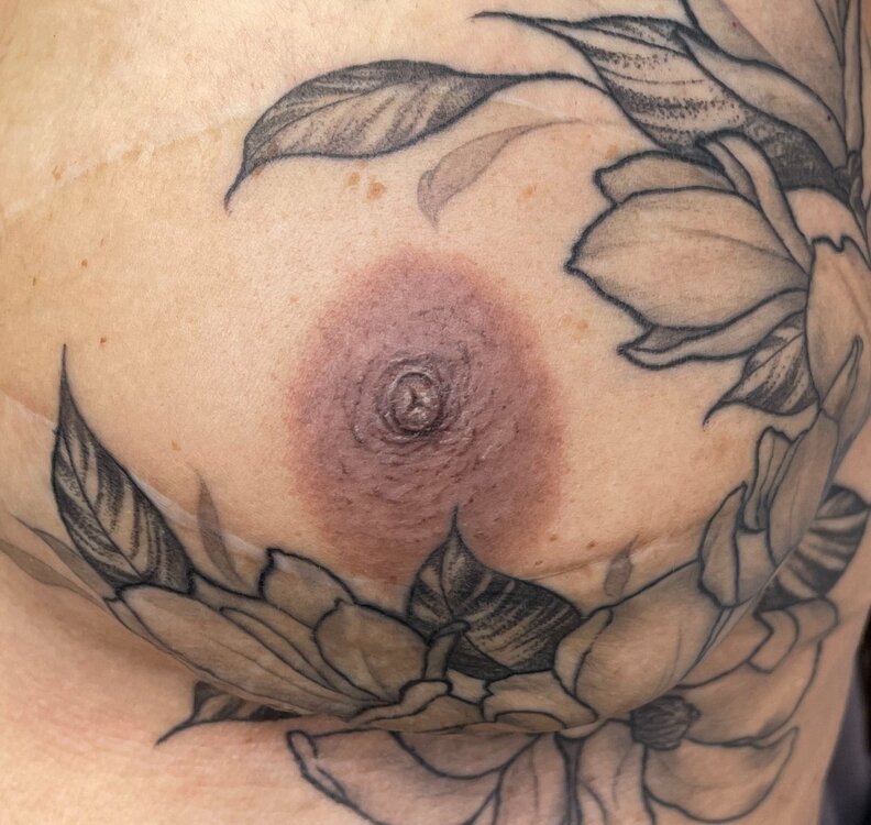 After areola tattoo
